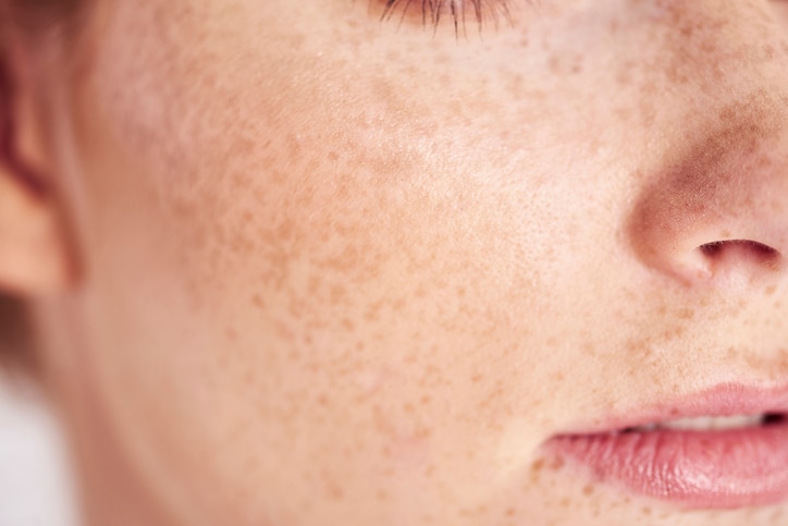 Close up of woman's face with freckles