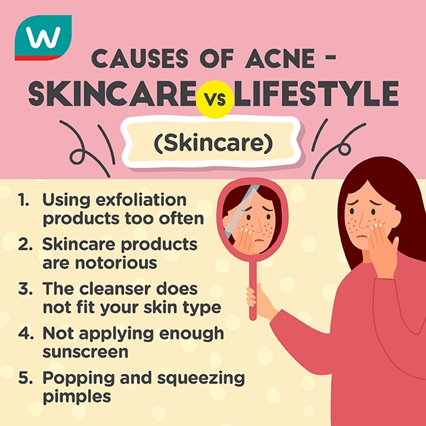 What causes acne, cause of acne