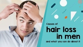 Causes of hair loss in men