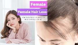 Female hair loss: How to check if you have too much hair fall or not