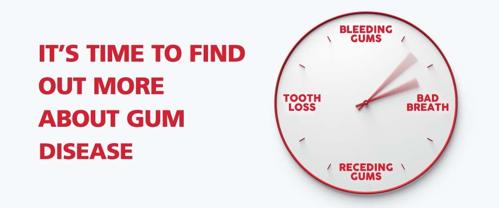 2. Parodontax_display banner_clock.jpg