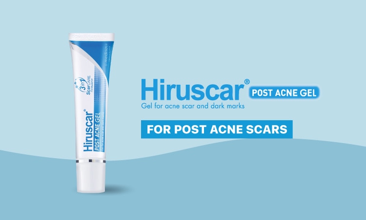 4. MY-Hiruscar-Watson-Brand-Page-CAT-750x452-HPA.jpg